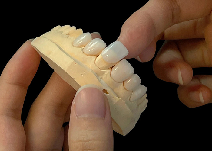 Porselen Shade Ultra Thin EMAX Veneers tahan noda untuk restorasi estetika