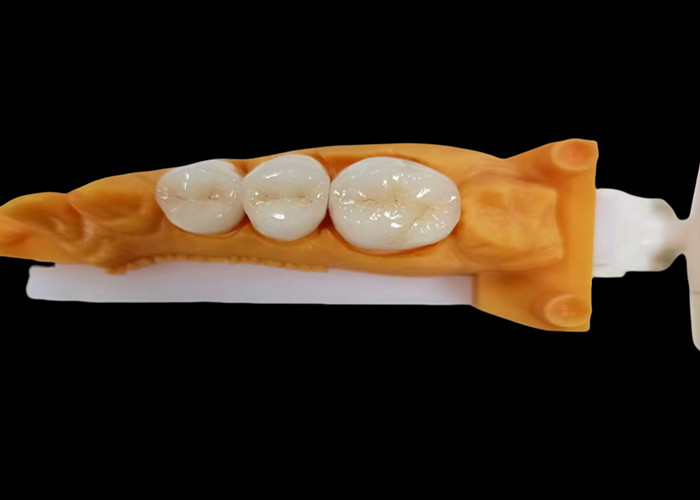 Pakaian tahan Zirconia Dental Crown dengan chip dan tahan noda dan estetika alami dari laboratorium gigi Cina