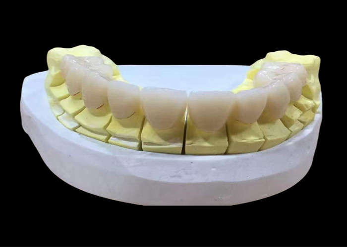 Zirconia porselen Dental Crown dengan Estetika dan Natural-looking Finish dari China laboratorium gigi
