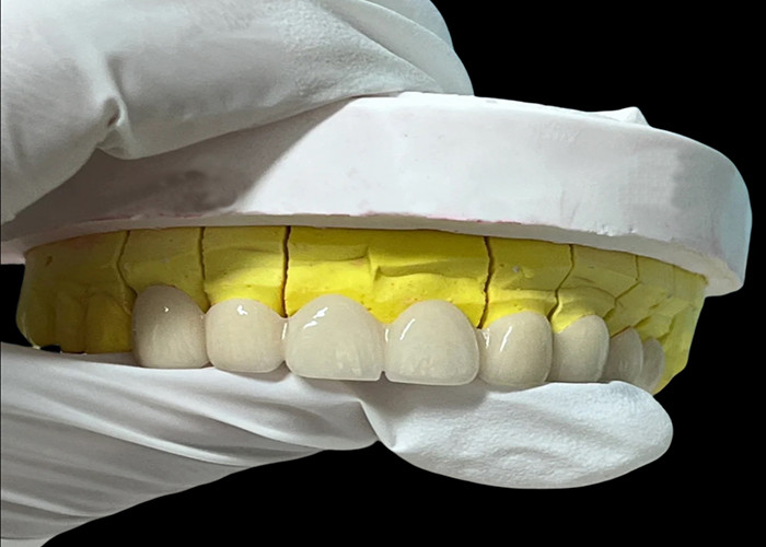 Zirconia porselen Dental Crown dengan Estetika dan Natural-looking Finish dari China laboratorium gigi