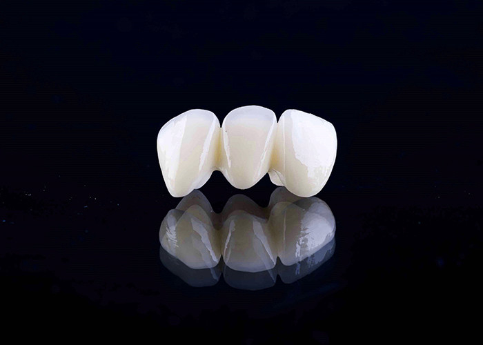 Zirconia porselen Dental Crown dengan Estetika dan Natural-looking Finish dari China laboratorium gigi