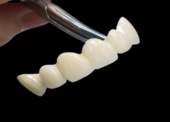 Custom Translucent Zirconia Dental Crown Dengan Durability Tinggi tahan noda dari China laboratorium gigi