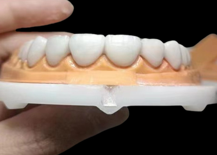 Custom Translucent Zirconia Dental Crown Dengan Durability Tinggi tahan noda dari China laboratorium gigi