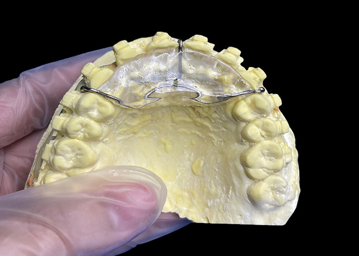 Custom Made Orthodontic Appliances menggigit pesawat untuk masalah gigitan yang benar atau di TMJ meringankan tekanan pada sendi rahang.