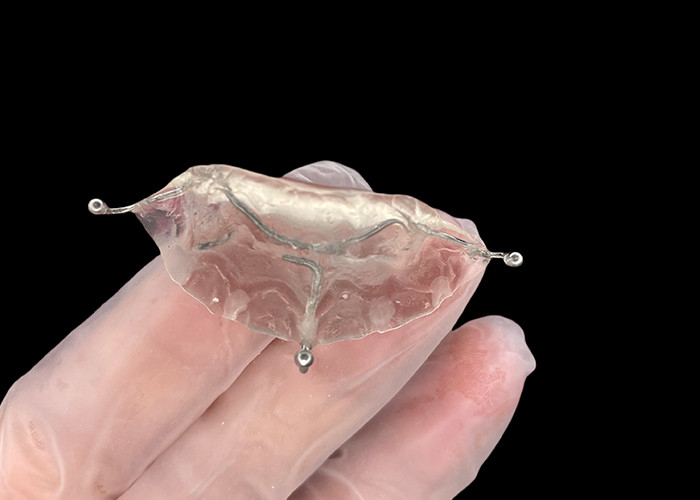 Custom Made Orthodontic Appliances menggigit pesawat untuk masalah gigitan yang benar atau di TMJ meringankan tekanan pada sendi rahang.