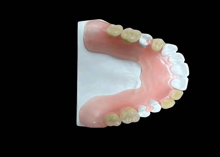 Full Acrylic Dentures Ringan tahan lama Terjangkau dan Disesuaikan Solusi untuk Ganti Gigi Lengkap