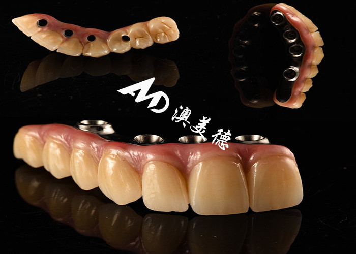 Dental Implan yang terlihat alami Jembatan mahkota Diperbaiki dengan titanium pilar untuk operasi gigi yang hilang