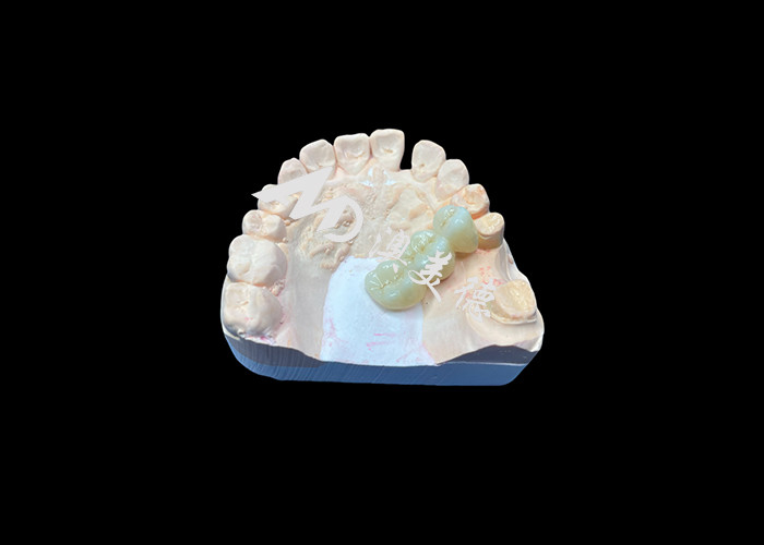 Warna alami Zirconia Dental Crown tahan retak untuk senyum sempurna dari China Dental Lab