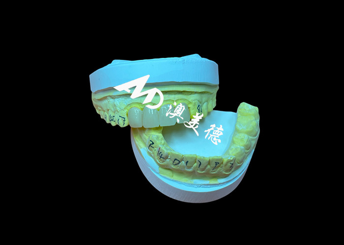 Restorasi gigi Translucent Zirconia Dental Crown Untuk Fit yang Tepat Dan Estetika Alam