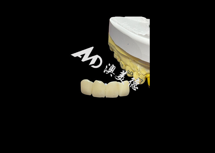 Restorasi gigi Translucent Zirconia Dental Crown Untuk Fit yang Tepat Dan Estetika Alam