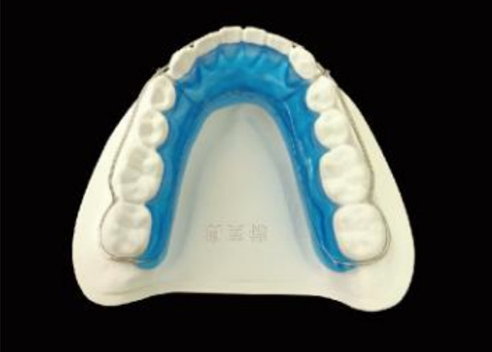 Pertahankan Senyum Anda dengan Begg Retainer untuk keselarasan yang sempurna dan hasil yang tahan lama