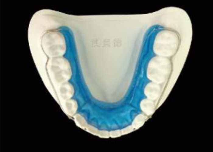Pertahankan Senyum Anda dengan Begg Retainer untuk keselarasan yang sempurna dan hasil yang tahan lama