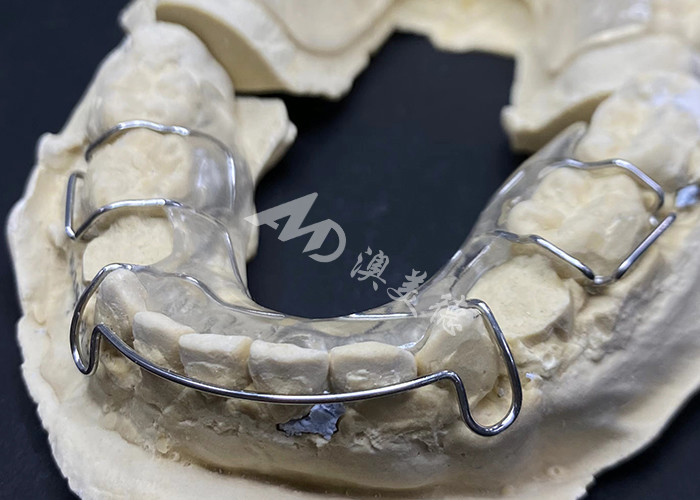 Nyaman Untuk Memakai AMD Dental Lab's Hawley Retainer Untuk Ortodontik yang Aman Dan Sehat