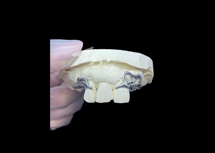 Easy Fit Custom Cast Partial Denture Frame yang stabil dan terlihat alami untuk hasil yang cepat