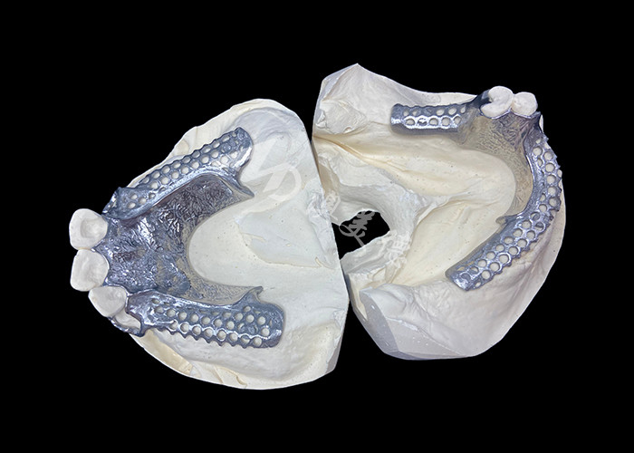Easy Fit Custom Cast Partial Denture Frame yang stabil dan terlihat alami untuk hasil yang cepat