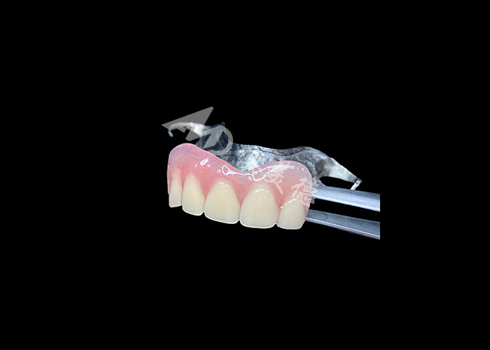 Dental parsial cast yang tahan lama Perawatan mudah untuk mengunyah yang lebih baik dan senyum yang sempurna