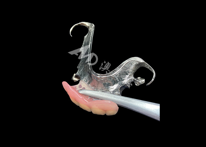 Dental parsial cast yang tahan lama Perawatan mudah untuk mengunyah yang lebih baik dan senyum yang sempurna