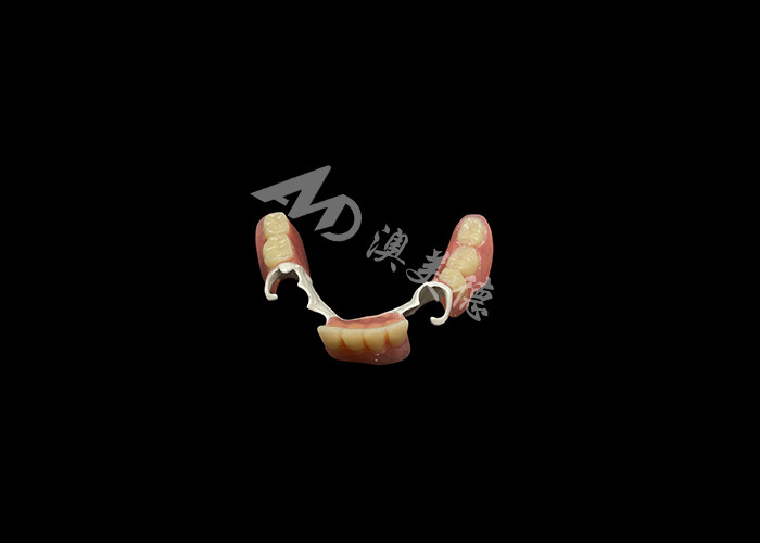 Custom Made Durable Cast Partial Dentures With Hpp Frame Untuk Memulihkan Senyum Anda
