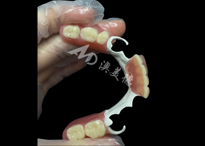 Custom Made Durable Cast Partial Dentures With Hpp Frame Untuk Memulihkan Senyum Anda