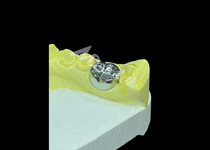 Fungsi tahan lama Crown Cast Full Metal yang tahan lama untuk restorasi gigi yang unggul