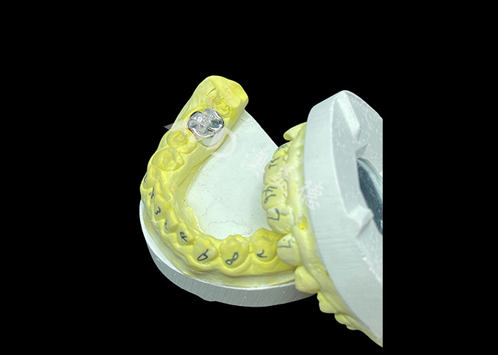 Fungsi tahan lama Crown Cast Full Metal yang tahan lama untuk restorasi gigi yang unggul