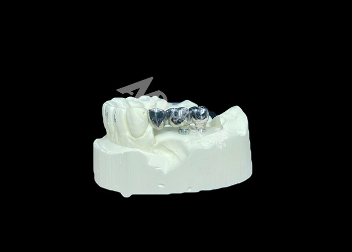 Implan Gigi Titanium Crown yang tahan lama untuk penggantian gigi yang hilang