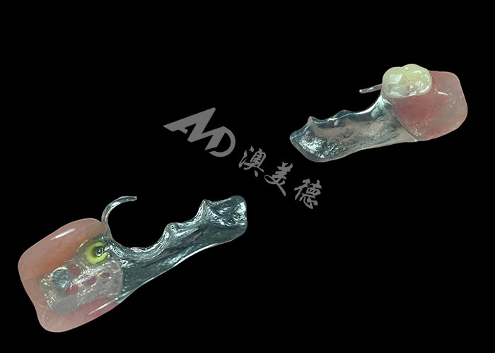 Dentitas Parsial Cast Customized Kerangka logam presisi untuk fit dan fungsi optimal