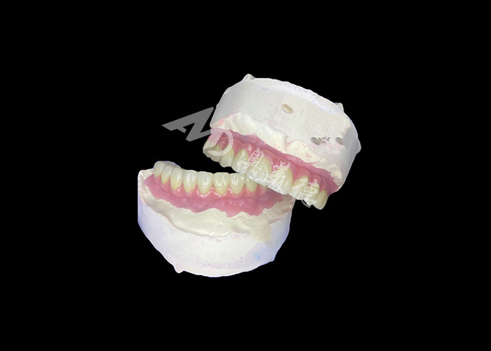 Dental All-on-6 Dental Implant Dukungan Gigi Dengan Stabilitas Dan Kenyamanan