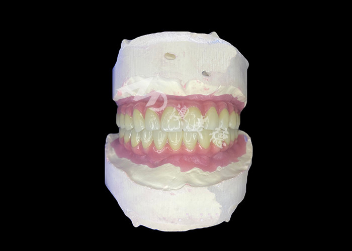 Dental All-on-6 Dental Implant Dukungan Gigi Dengan Stabilitas Dan Kenyamanan