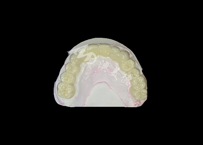 Jembatan Gigi Zirconia Translucence Tinggi Kuat dan Alami Mencari Restorasi Senyum yang Sempurna