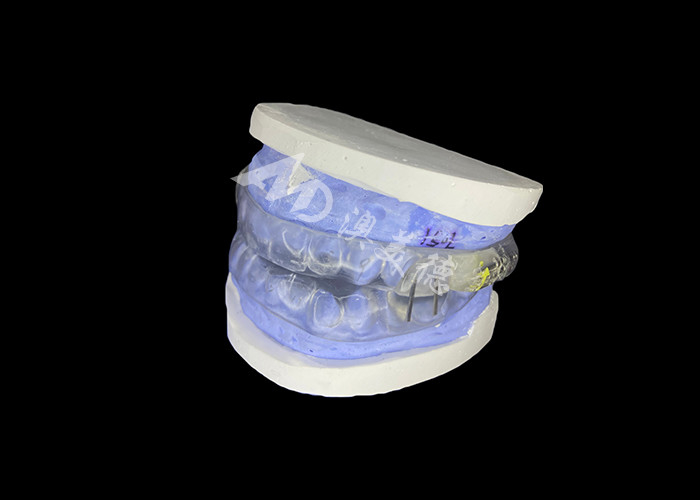 Shark Anti-Snoring Device Adjustable Mandibular Advancement Device Untuk Memperbaiki Bantuan Snoring Dan Peningkatan Tidur