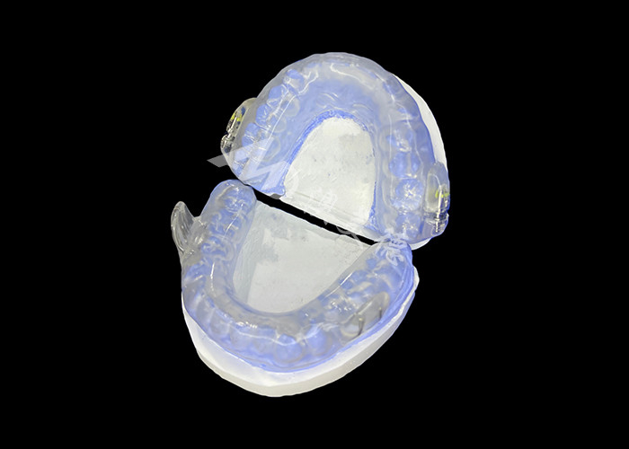 Shark Anti-Snoring Device Adjustable Mandibular Advancement Device Untuk Memperbaiki Bantuan Snoring Dan Peningkatan Tidur