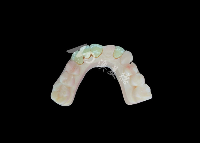 Natural dan Nyaman Pas Zirconia Porselen Mahkota Cina Dental Lab Shade Disesuaikan