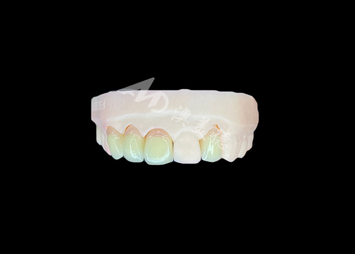 Natural dan Nyaman Pas Zirconia Porselen Mahkota Cina Dental Lab Shade Disesuaikan