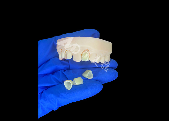 Natural dan Nyaman Pas Zirconia Porselen Mahkota Cina Dental Lab Shade Disesuaikan