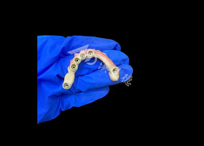 Titanium Abutment dan Zirconia Crown Implant Dental Didukung Presisi Cocok untuk Pakai Nyaman