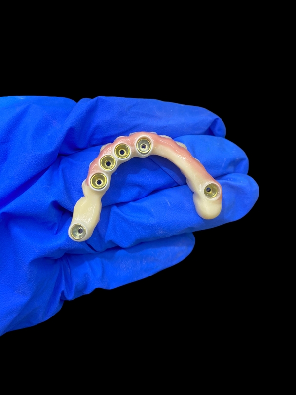 Titanium Abutment dan Zirconia Crown Implant Dental Didukung Presisi Cocok untuk Pakai Nyaman