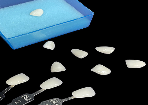 Harga yang bagus Porselen Emax Veneer Translucence Bonding Untuk Restorasi Estetika yang Tepat on line
