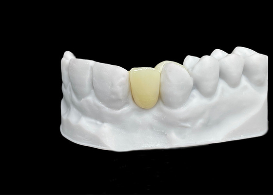 Harga yang bagus Ketahanan Celah Zirconia mahkota gigi dengan kekuatan dan translucence luar biasa on line