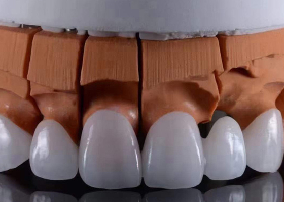 Harga yang bagus FDA Disetujui Translucent Zirconia Mahkota Gigi Pas Tepat dengan penampilan estetika alami on line