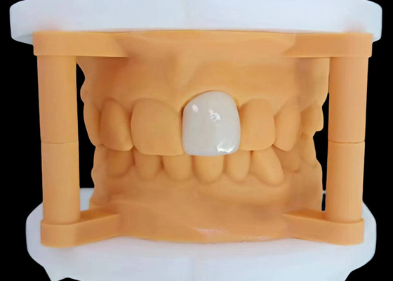 Harga yang bagus Translucence Zirconia Dental Crown dengan Kinerja Estetika dari China Dental Lab on line