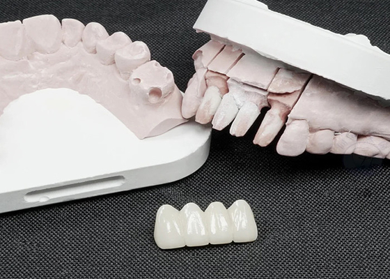 Harga yang bagus Mahkota Gigi Zirconia Premium untuk Kekuatan Superior dan Estetika Alam on line
