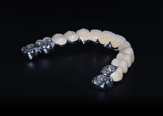 Harga yang bagus High Durability Biocompatible Porcelain Digabungkan Dengan Metal Crown Precise Fit Custom on line