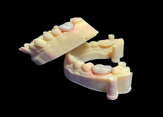 Harga yang bagus Biocompatible Dental Zirconia Crown Untuk Gigi Tunggal / Multiple Kekuatan Tinggi on line