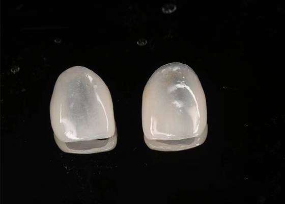 Harga yang bagus Restorasi Estetika Emax Ceramic Veneers Translucence dengan permukaan yang dipoles on line