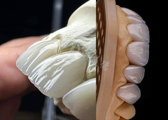 Harga yang bagus Dental yang tahan lama... mahkota zirconia yang kokoh... on line