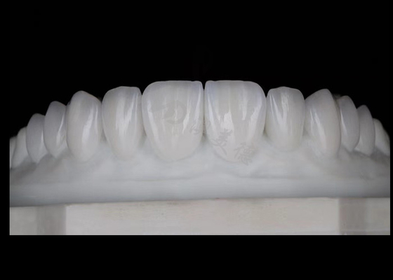 Harga yang bagus Translucence Natural Esthetic Zirconia Mahkota Biokompatibilitas dan Kekuatan yang Luar Biasa on line