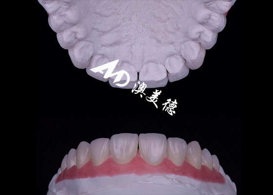 Harga yang bagus Translucence EMAX Porcelain Veneer Tahan terhadap noda / Kekuatan on line