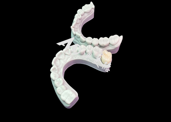 Harga yang bagus Pas tepat Zirconia Dental Crown Estetika Warna alami Biokompatibilitas yang sangat baik on line