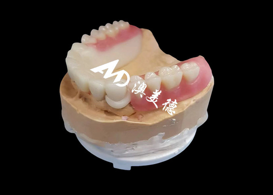 Harga yang bagus Customized Hpp Frame Acrylic Removable Partial Denture Untuk Gigi Yang Hilang on line